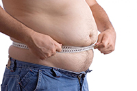 Алиментарное ожирение абдоминальное (по мужскому типу). Атерогенная дислипедемия